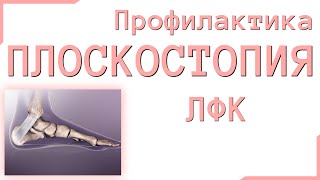 Гимнастика при плоскостопии