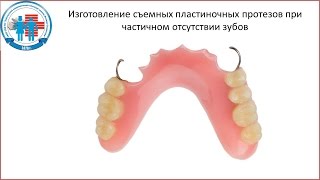 Изготовление съемных пластиночных протезов при час