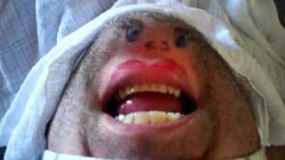 Ali and his hairy faced lady chin heads