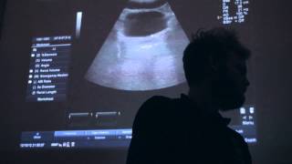 Vi scanner kroppen! - Ultralydsscanning