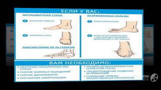 удобная накладка от вальгусной деформации

  - Valgus Pro - Обзор Фиксатора