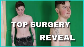 TOP SURGERY REVEAL (FTM) -  VLOG PART 2