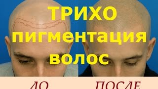Трихопигментация волос. Как это выгляядит