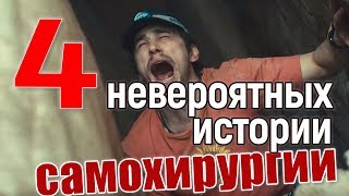 4 невероятные истории об операциях на самом себе! #боль #смелость #отчаяние #жесть