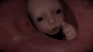 vore babi