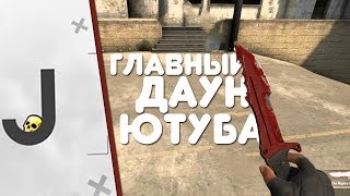 Главный ДАУН ЮТУБА по CS:GO - JOSKIY l жоский, жёсткий, жёский l разоблачение l dimetrix l cs go