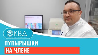 Пупырышки на члене. Клинический случай №56