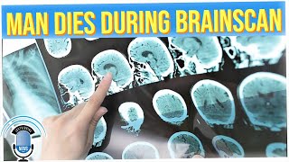 First-Ever Scan of a Dying Human Brain Reveals What Happens