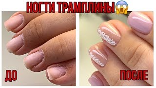НОГТИ ТРАМПЛИНЫ?Преображение вверх растущих ногтей?Простой маникюр