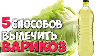 Как Лечить ВАРИКОЗ? ✅5 Способов Лечения ВАРИКОЗА Вен Народными Средствами