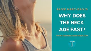 Why Does The Neck Age So Fast? | Alice Hart-Davis