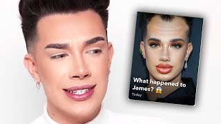 James Charles Reacts To Balding Photo Going Viral