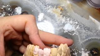e-max build up