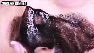 удаление черных точек на носу видео