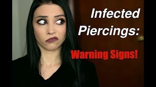 Infected Piercings: The Warning Signs & What To Watch For!
