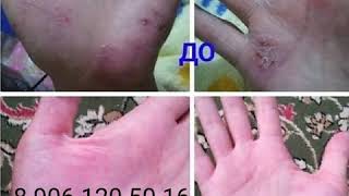 Результаты!!! Шокирующие результаты!!! Нано-бальзамы Перфекто Люкс и Виталити Люкс