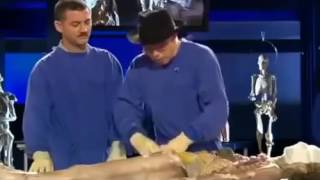 Autopsy   Life and Death   Cancer 2