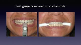 Part Three - Centric Relation & Equilibration