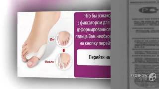 valgus pro купить в аптеке

  - Скидка до 60% на ортопедический фиксатор