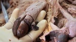 Anatomy Dissection of the Penis