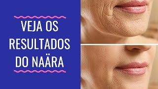 Para que serve colágeno hidrolisado, colágeno hidrolisado