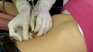 belly button piercing