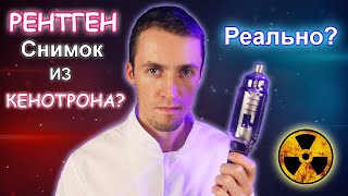 Рентген снимок с Кенотрона. Миф или Реальность?
