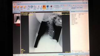 How to use the agnosco DICOM viewer on Pacsgenie
