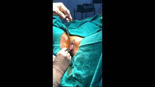 Hematocolpus