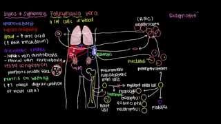 What is polycythemia vera?