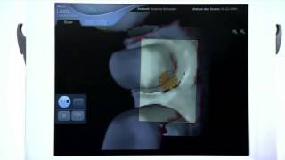 3D Сканер вместо зубных слепков. Lava™ Chairside Oral Scanner