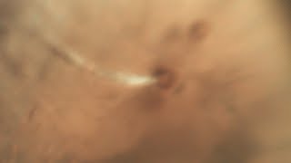The Arsia Mons Elongated Cloud