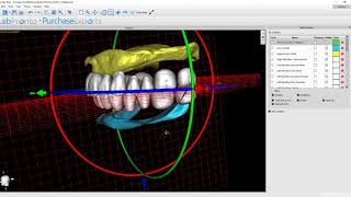 Step 3  Setting Teeth in the Blue Sky Plan Denture Module  v 4 7 15