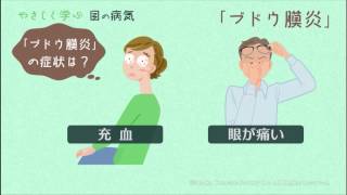 やさしく学ぶ－目の病気　ブドウ膜炎