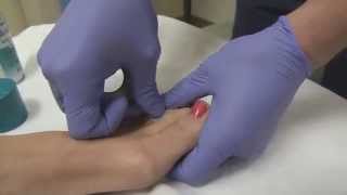 Broken Toe Emergency