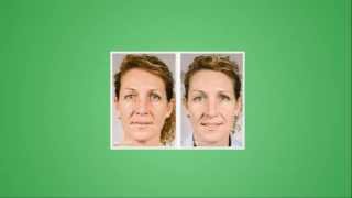 Best Anti Wrinkle Cream