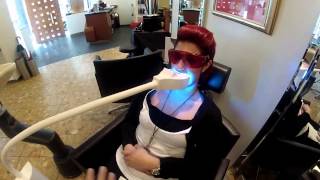Zahnbleaching Tutorial Anwendung 03web