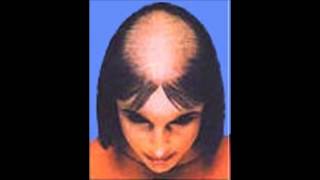 QUEDA DE CABELO APÓS CIRURGIA BARIÁTRICA