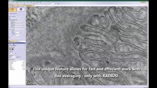 RADIUS - Smart Averaging (with MegaView G3)