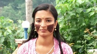 Home Remedy For Acne - How To Get Rid of Acne Wrinkes - Facials & Face Pack