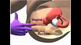 Pelvic Exam 14 min
