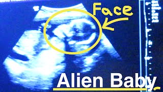 OUR BABY LOOKS LIKE AN ALIEN!