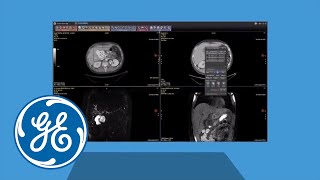Molecular Imaging Demos on Demand Integrated Registration