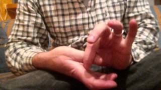 Thumb amputee
