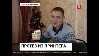 Трое самоучек сделали протезы
