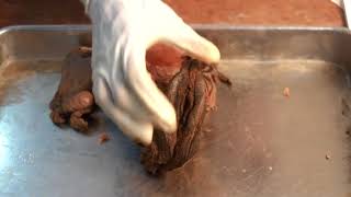 Female genitalia: vagina and external genitalia with features (3rd part)