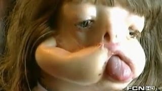 Новое лицо Джулианы (продолжение) - Моя Ужасная История