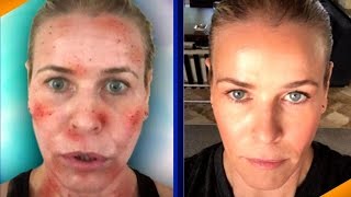 Beauty Confidential: Star Laser Secrets