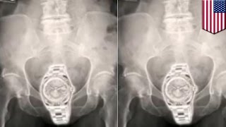 Cache,cache: 3 femmes ont été arrêtées pour avoir introduit 12,000 euros dans leur cachette secrète.
