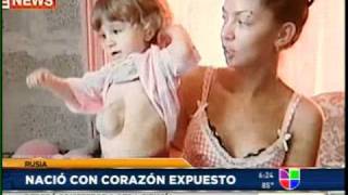 Niña Nace Con El Corazon Casi Afuera (Insolito)